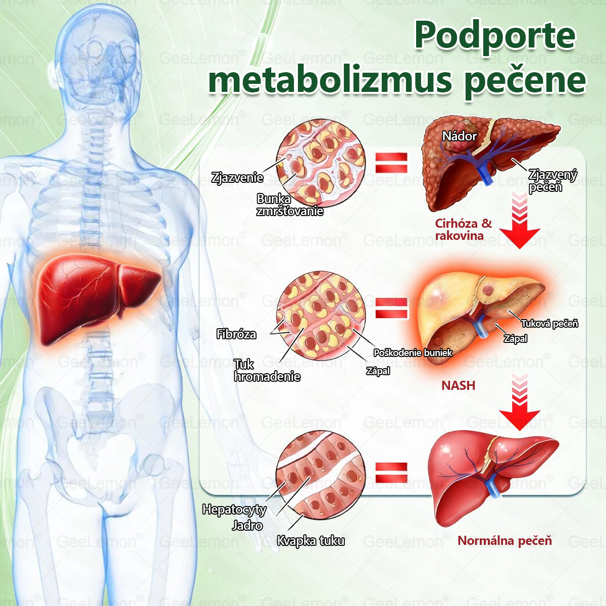 Odporúčané UNB · 👩‍⚕️Oficiálny obchod Dr. Max | 🎁 𝐆𝐞𝑒𝐿𝑒𝐦𝐨𝐧® Glumasetide 8 v 1 Nano mikrotŕňový náplasť – Len raz denne ✅ Viditeľné zmeny za 7 dní na obezitu, ochabnutú pokožku a zdravie